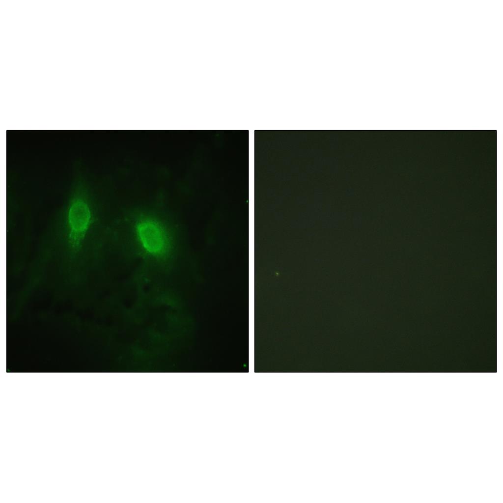 IKKγ兔多抗,IKKγ Rabbit Polyclonal Antibody