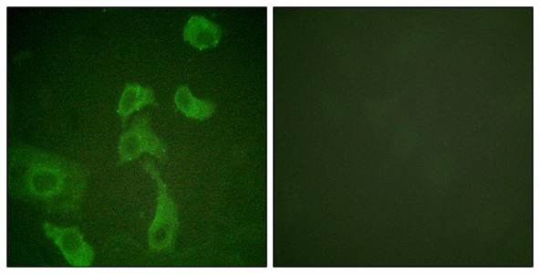 IL-2Rβ兔多抗,IL-2Rβ Rabbit Polyclonal Antibody