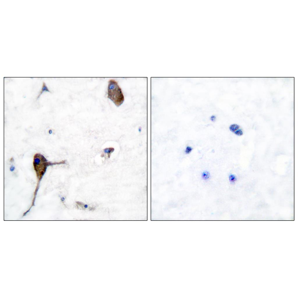 IL-3Rβ兔多抗,IL-3Rβ Rabbit Polyclonal Antibody