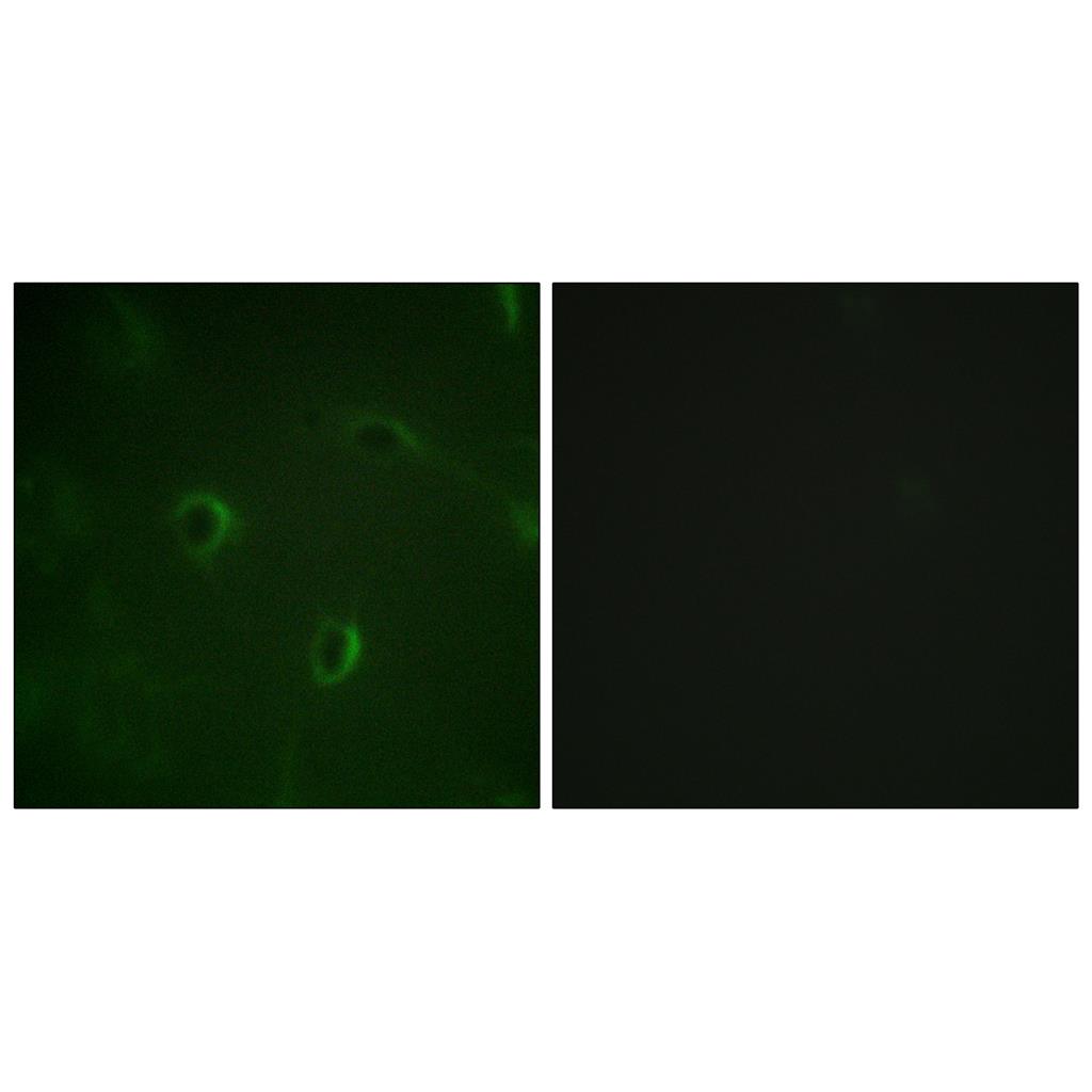 Insulin R兔多抗,Insulin R Rabbit Polyclonal Antibody