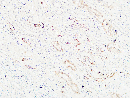 K-Ras兔多抗,K-Ras Rabbit Polyclonal Antibody