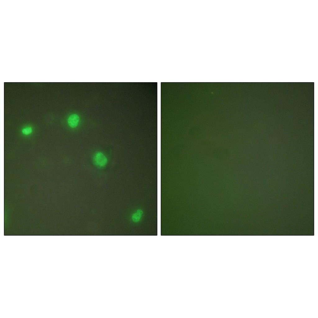 Ku-70兔多抗,Ku-70 Rabbit Polyclonal Antibody