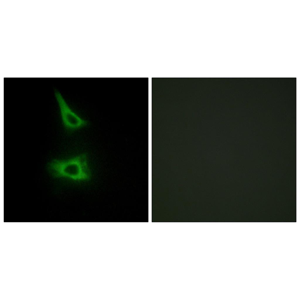 LI-cadherin兔多抗,LI-cadherin Rabbit Polyclonal Antibody