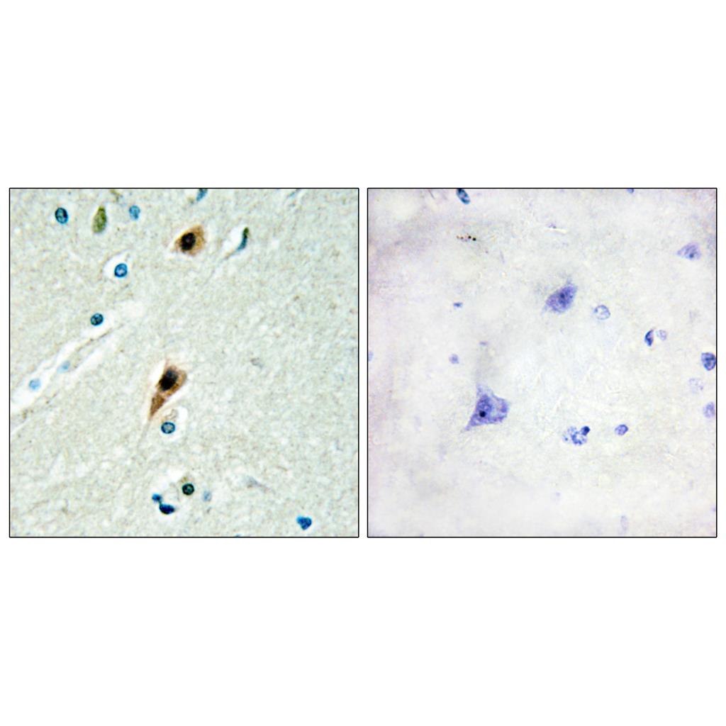LUCA15兔多抗,LUCA15 Rabbit Polyclonal Antibody