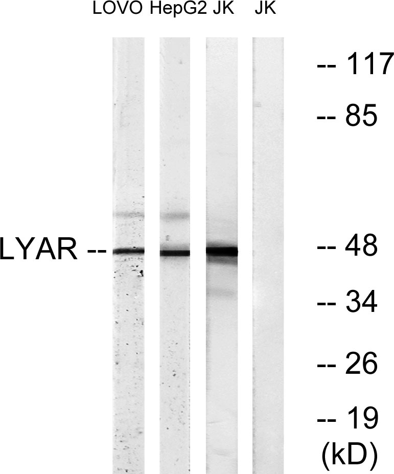 LYAR兔多抗,LYAR Rabbit Polyclonal Antibody