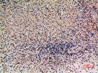 Lymphotactin兔多抗,Lymphotactin Rabbit Polyclonal Antibody