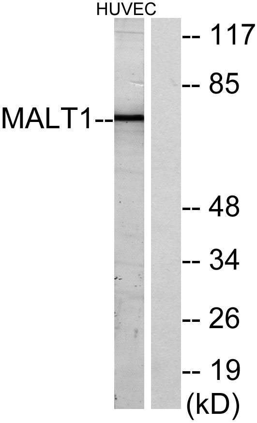 MALT1兔多抗,MALT1 Rabbit Polyclonal Antibody