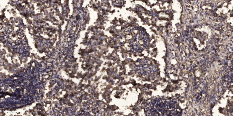 MAP1B兔多抗,MAP1B Rabbit Polyclonal Antibody