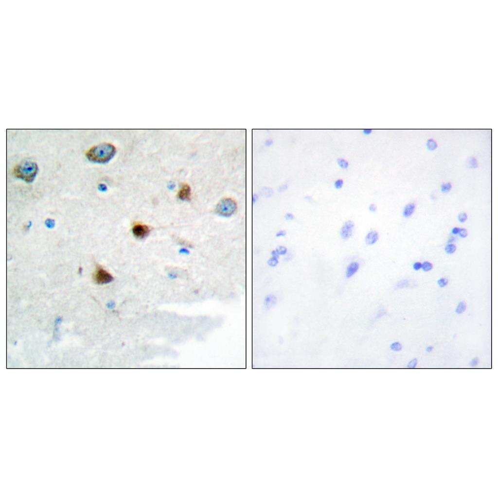 MKP-2兔多抗,MKP-2 Rabbit Polyclonal Antibody