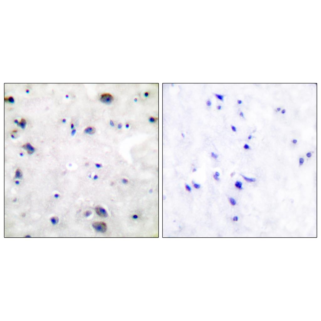 MOR-1兔多抗,MOR-1 Rabbit Polyclonal Antibody