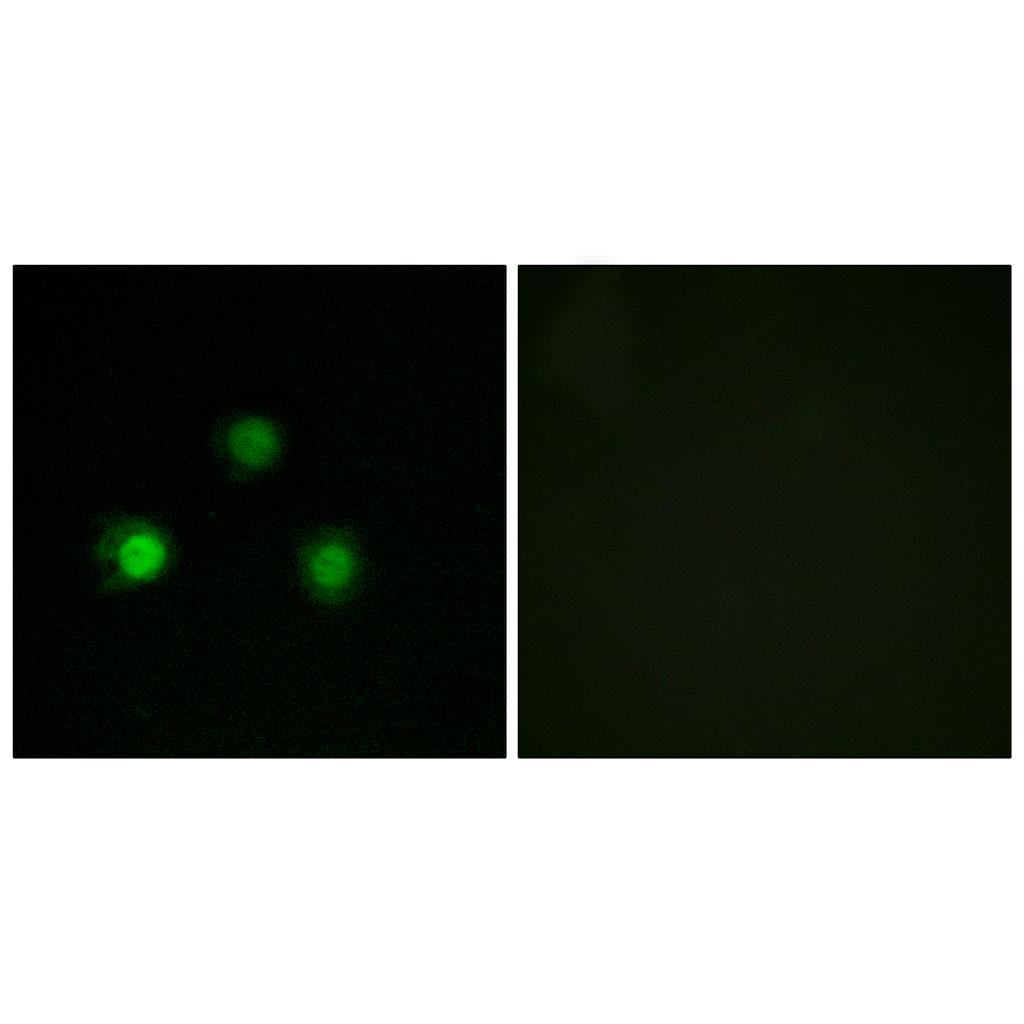 MSH2兔多抗,MSH2 Rabbit Polyclonal Antibody