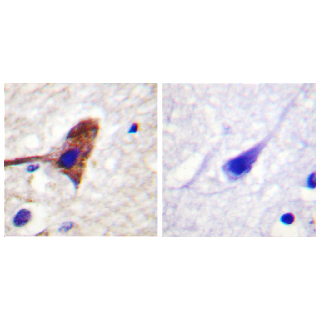 mTOR兔多抗,mTOR Rabbit Polyclonal Antibody