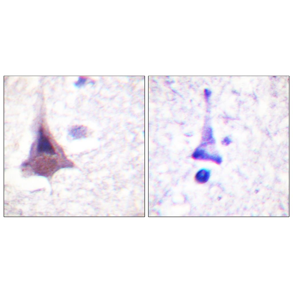 MYPT1兔多抗,MYPT1 Rabbit Polyclonal Antibody