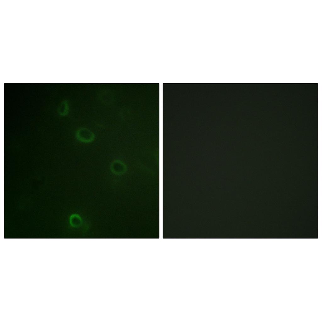 Na+/K+-ATPase α1兔多抗,Na+/K+-ATPase α1 Rabbit Polyclonal Antibody