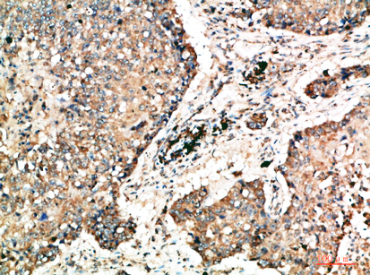 Napsin A兔多抗,Napsin A Rabbit Polyclonal Antibody