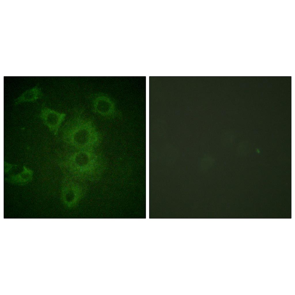 NBK兔多抗,NBK Rabbit Polyclonal Antibody