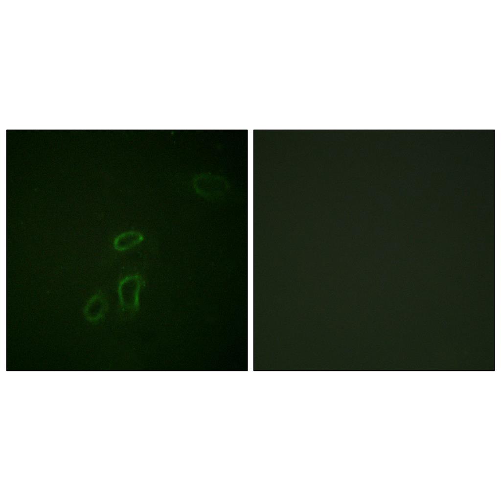 NCAM-L1兔多抗,NCAM-L1 Rabbit Polyclonal Antibody