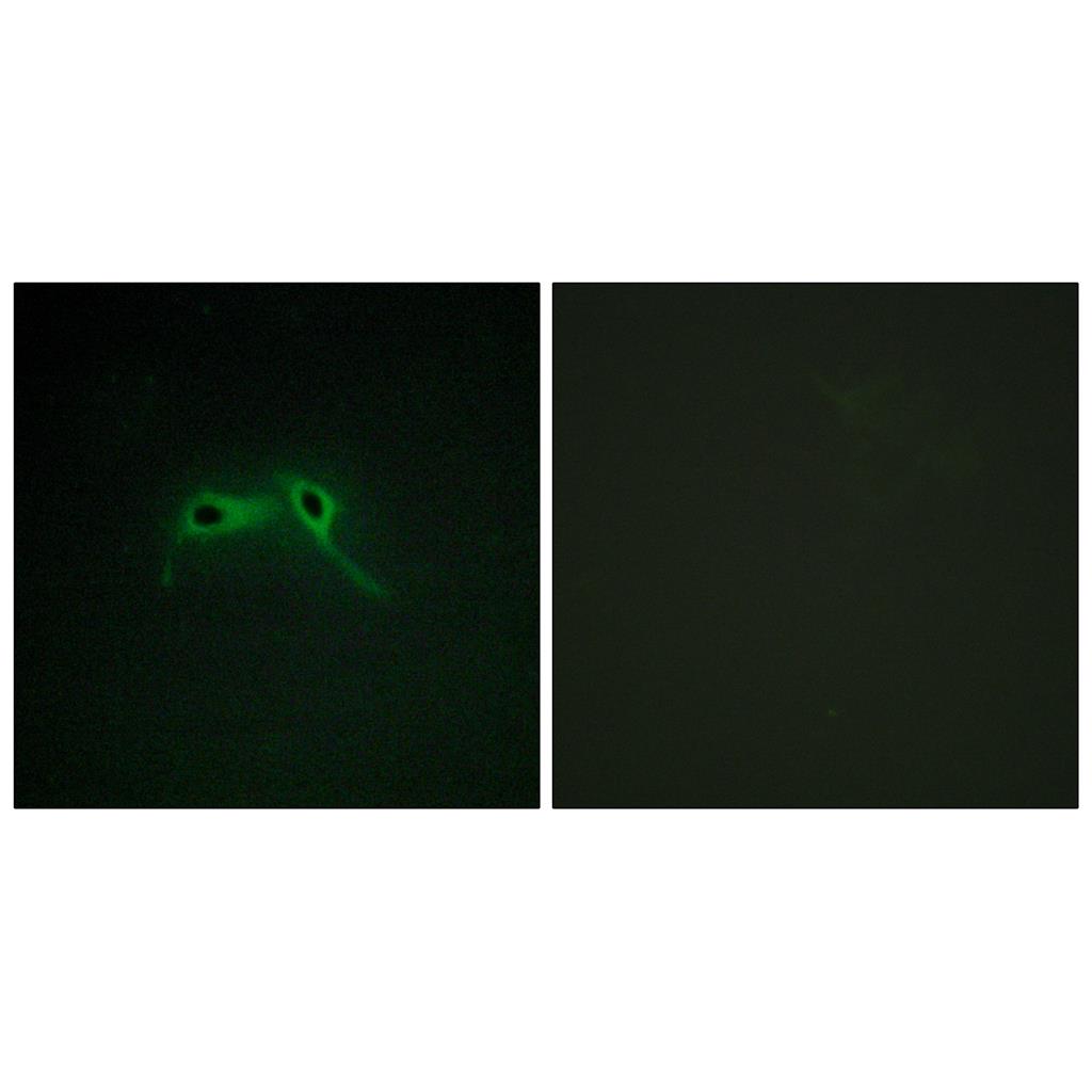 Neurofibromin兔多抗,Neurofibromin Rabbit Polyclonal Antibody