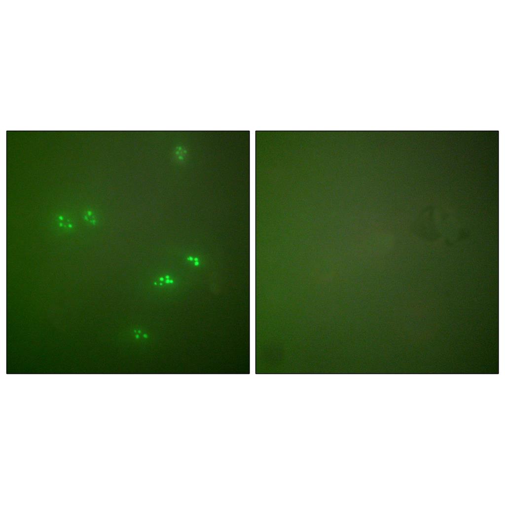 p14兔多抗,p14 Rabbit Polyclonal Antibody