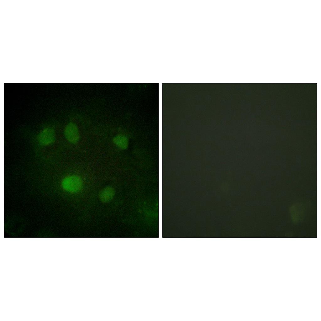 p68 RNA Helicase兔多抗,p68 RNA Helicase Rabbit Polyclonal Antibody