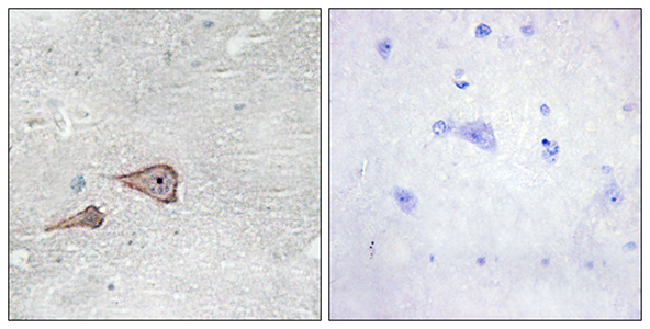 P-cadherin兔多抗,P-cadherin Rabbit Polyclonal Antibody
