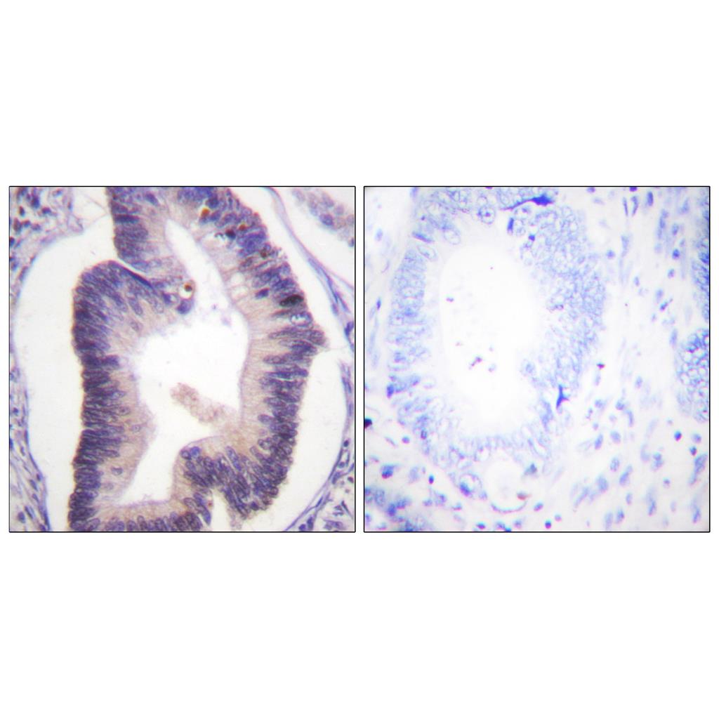 PFK-2 car兔多抗,PFK-2 car Rabbit Polyclonal Antibody