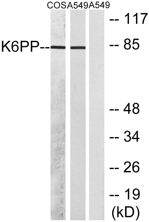 PFK-C兔多抗,PFK-C Rabbit Polyclonal Antibody