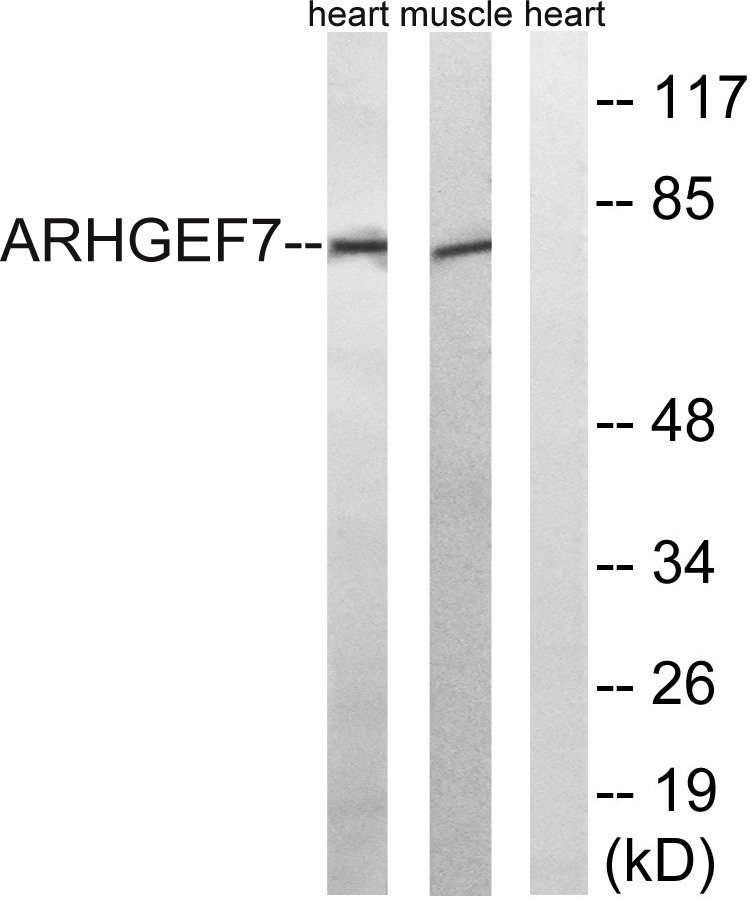 PIXβ兔多抗,PIXβ Rabbit Polyclonal Antibody
