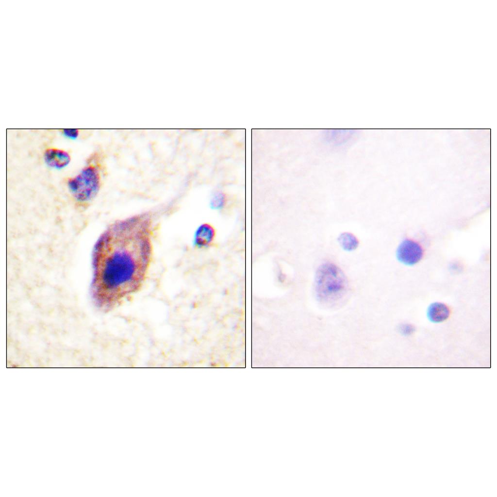 PLC γ2兔多抗,PLC γ2 Rabbit Polyclonal Antibody