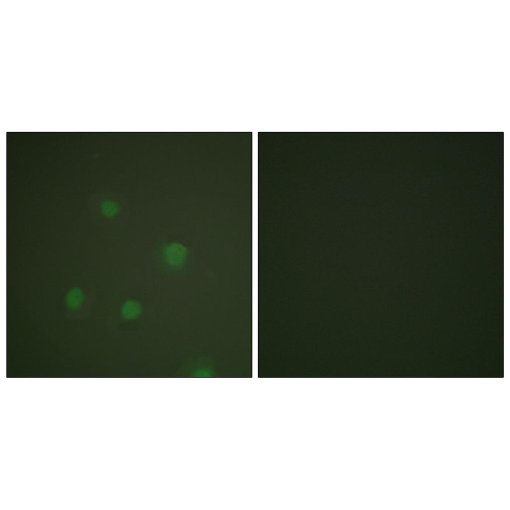 PR兔多抗,PR Rabbit Polyclonal Antibody