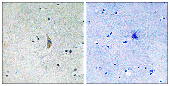 Presenilin 1兔多抗,Presenilin 1 Rabbit Polyclonal Antibody