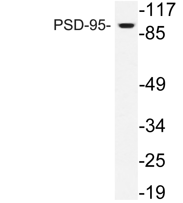 PSD-95兔多抗,PSD-95 Rabbit Polyclonal Antibody
