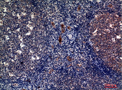 P-Selectin兔多抗,P-Selectin Rabbit Polyclonal Antibody