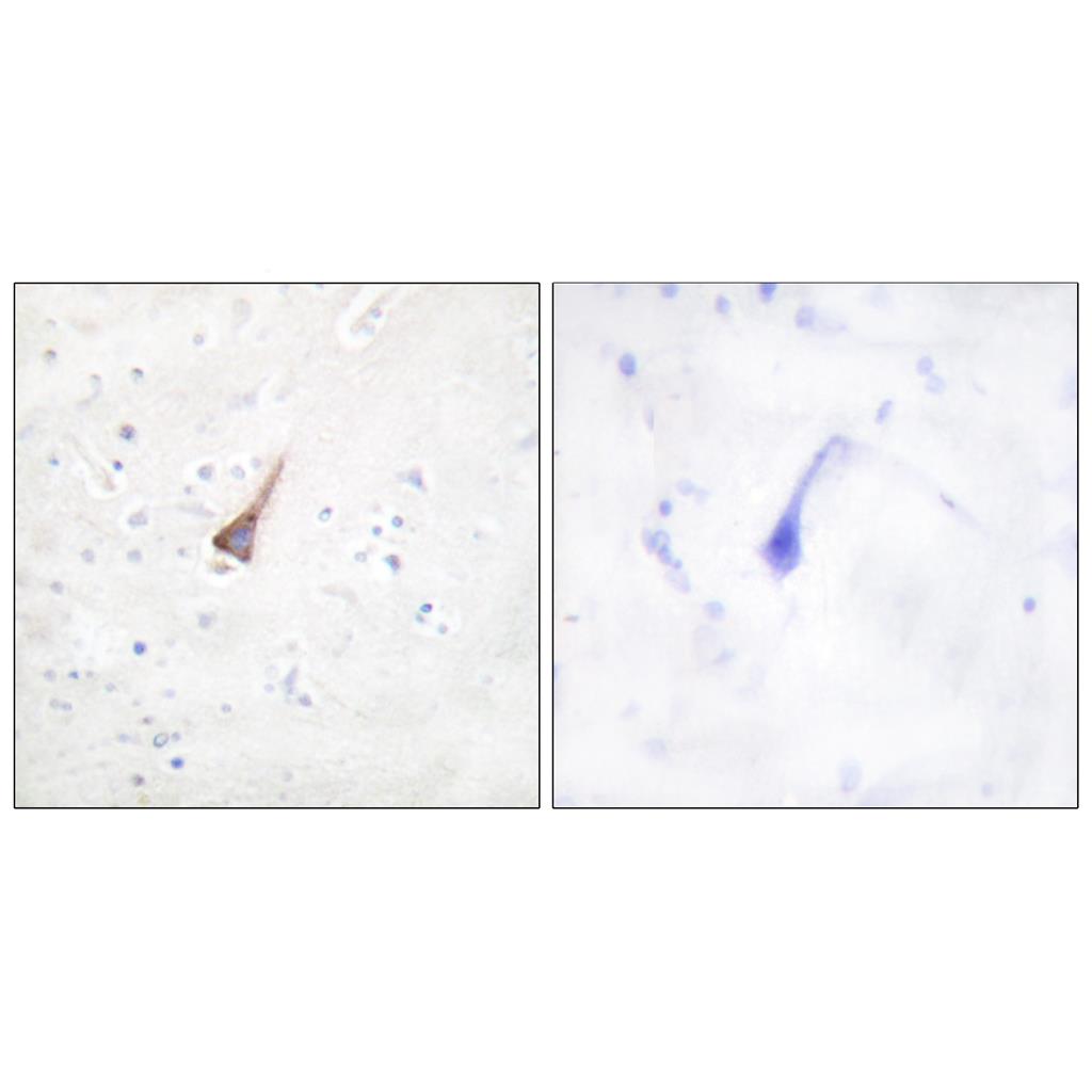 PTP1B兔多抗,PTP1B Rabbit Polyclonal Antibody