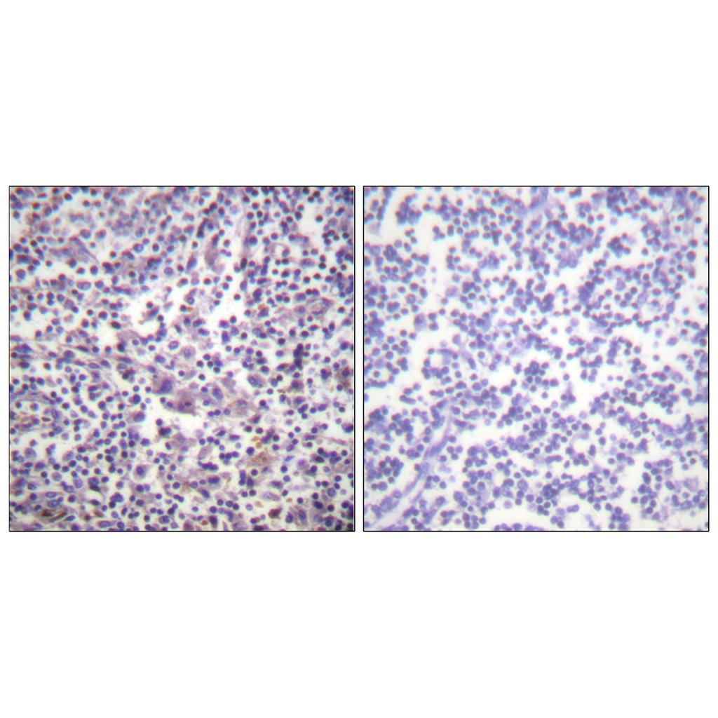 Raf-B兔多抗,Raf-B Rabbit Polyclonal Antibody