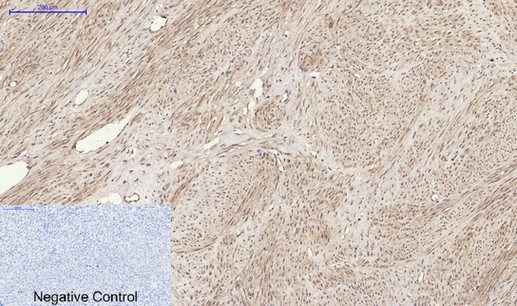 RANKL兔多抗,RANKL Rabbit Polyclonal Antibody