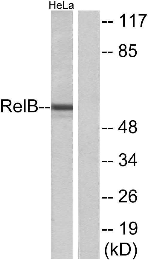 RelB兔多抗,RelB Rabbit Polyclonal Antibody