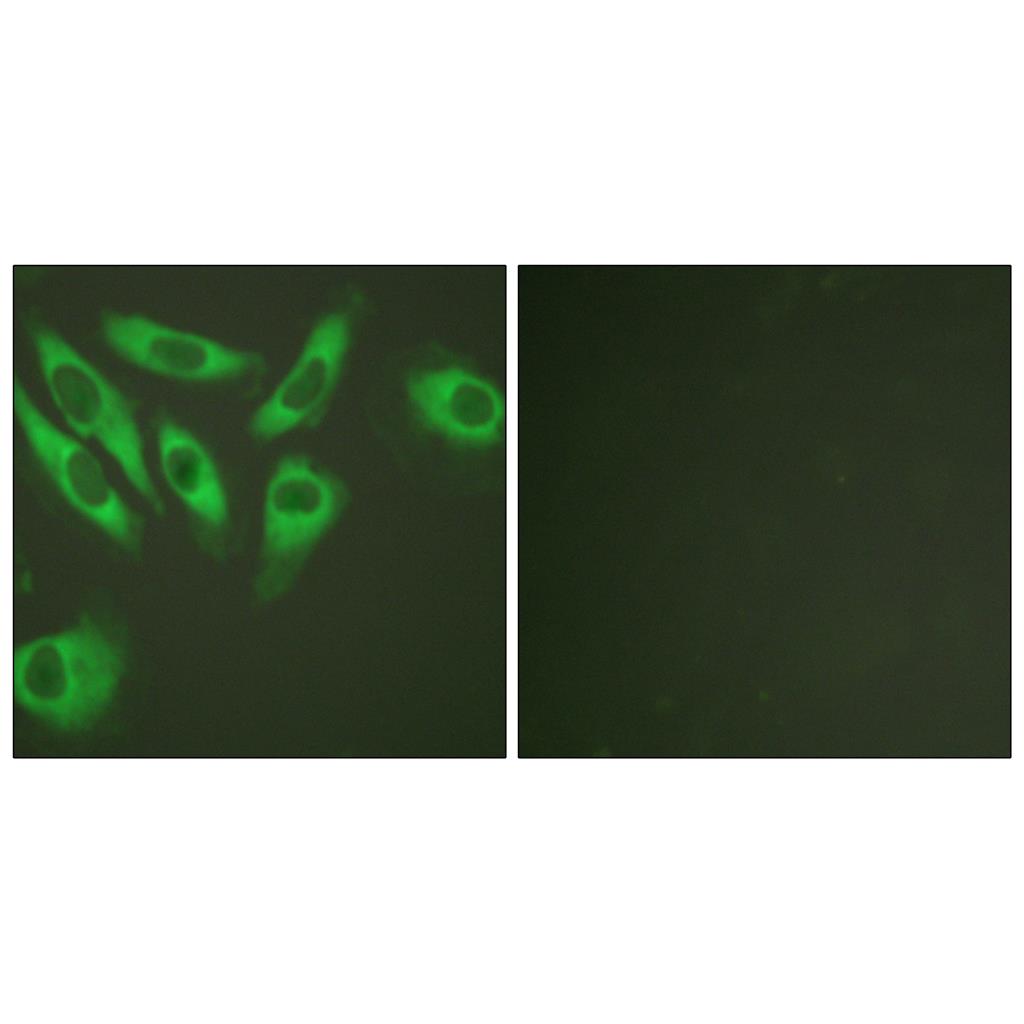 Ribosomal Protein S6兔多抗,Ribosomal Protein S6 Rabbit Polyclonal Antibody
