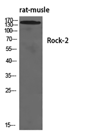 Rock-2兔多抗,Rock-2 Rabbit Polyclonal Antibody