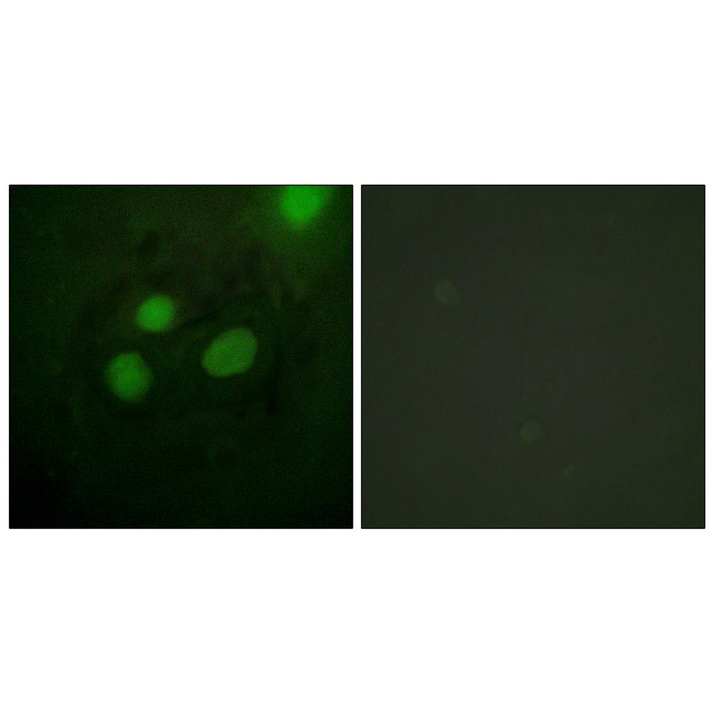RPA32兔多抗,RPA32 Rabbit Polyclonal Antibody