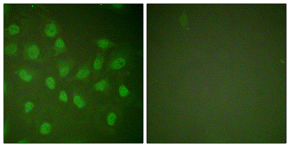 Rpb1兔多抗,Rpb1 Rabbit Polyclonal Antibody