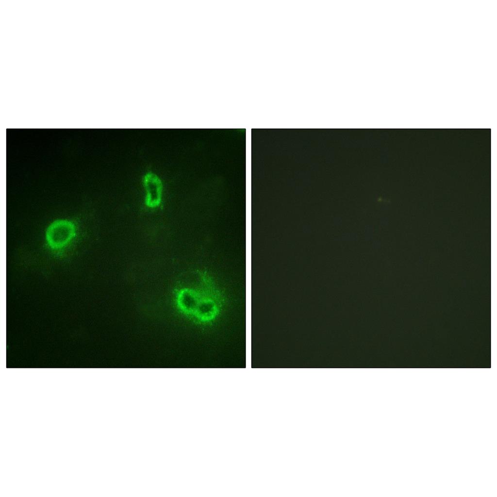 Rsk-1兔多抗,Rsk-1 Rabbit Polyclonal Antibody