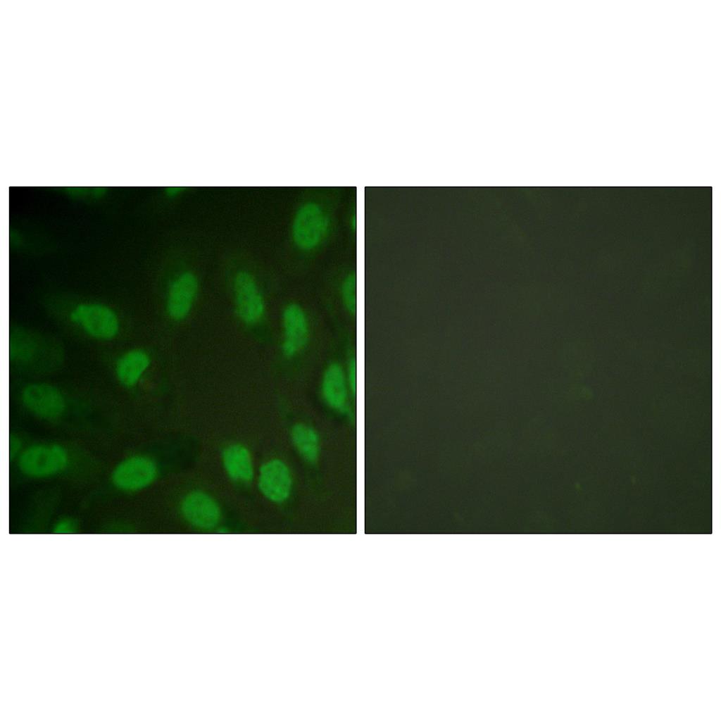 RUNX1兔多抗,RUNX1 Rabbit Polyclonal Antibody