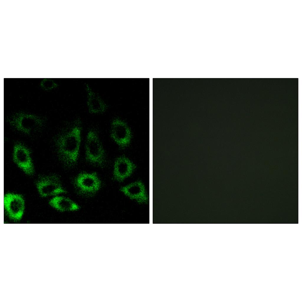 S2P兔多抗,S2P Rabbit Polyclonal Antibody