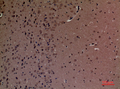 SHIP-2兔多抗,SHIP-2 Rabbit Polyclonal Antibody