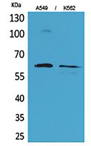 Smad1兔多抗,Smad1 Rabbit Polyclonal Antibody