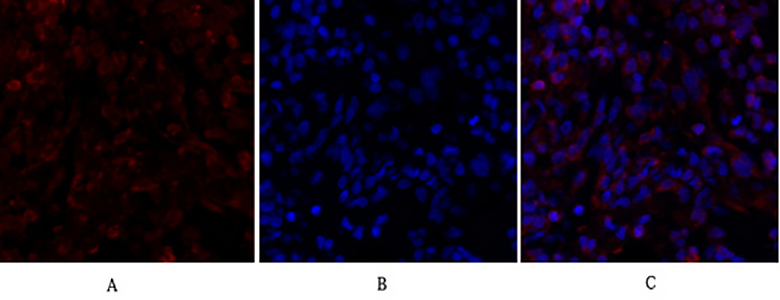 Smad4兔多抗,Smad4 Rabbit Polyclonal Antibody