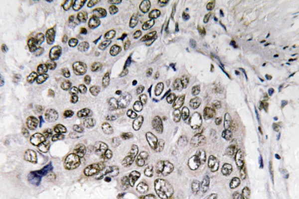 Smad6兔多抗,Smad6 Rabbit Polyclonal Antibody