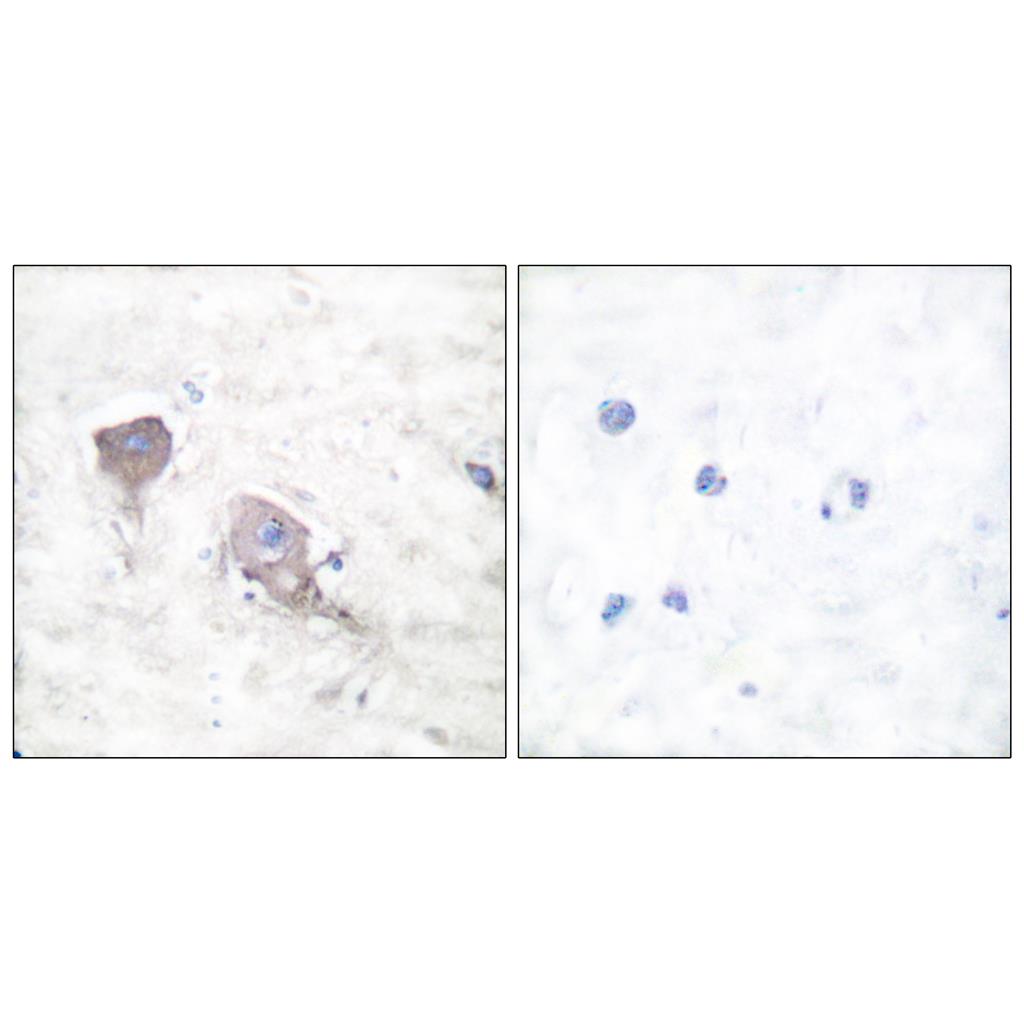 SNAP 25兔多抗,SNAP 25 Rabbit Polyclonal Antibody