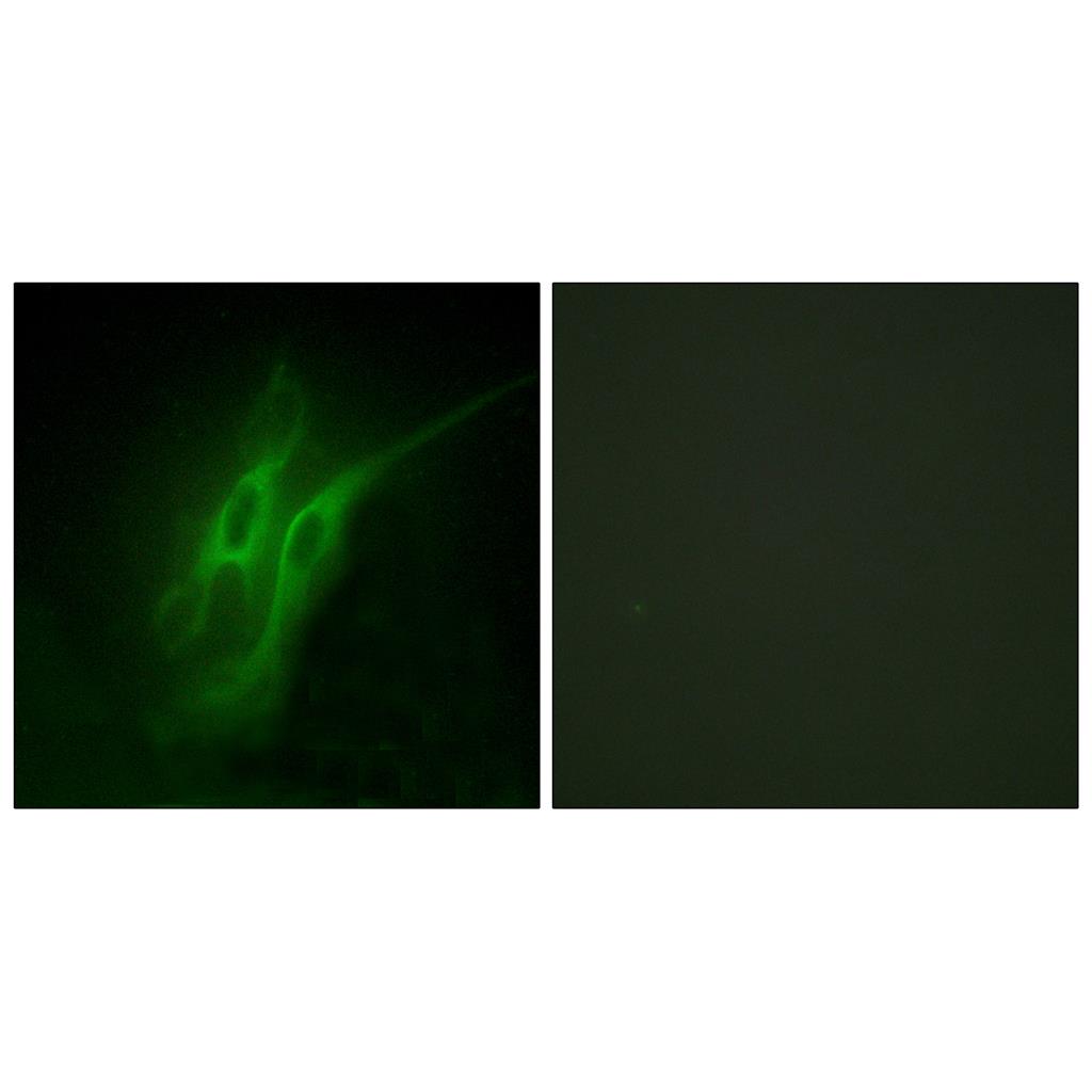 SR-4兔多抗,SR-4 Rabbit Polyclonal Antibody